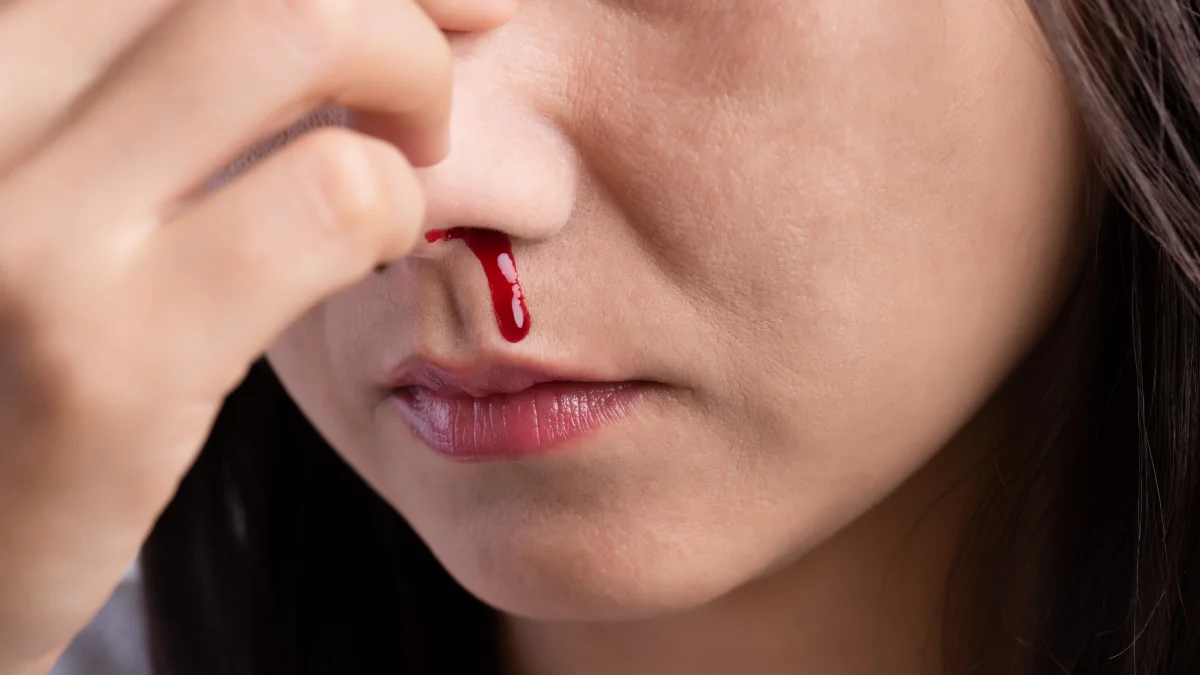 Sangrado nasal en adultos